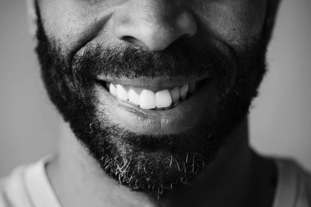 closeup-of-smiling-teeth-of-a-black-man