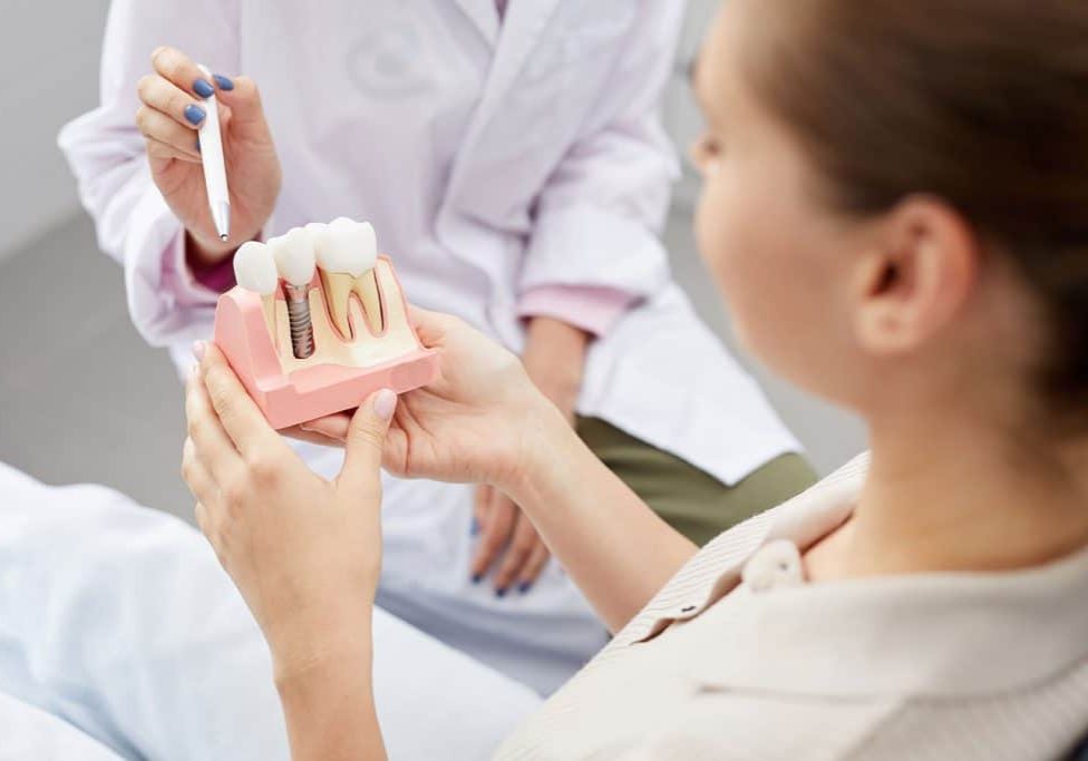 tooth-implantation-model